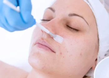 Hyperpigmentation Help: How Chemical Peels Beat Skin Discoloration