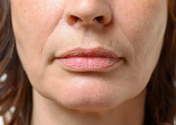 Say Goodbye to Jowls: How Newcastle’s Cutting-Edge Treatments Can Help