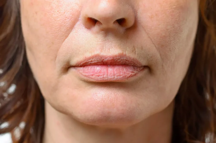 Say Goodbye to Jowls: How Newcastle’s Cutting-Edge Treatments Can Help