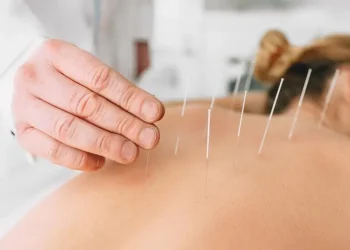 Demystifying Acupuncture: What To Expect From Treatments in South Kensington