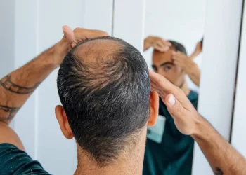 Balancing Benefits and Risks: Topical Finasteride in Hair Loss Treatment