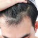 Exploring the Impact of 2 Deoxy D Ribose Hair Serum on Hair Health