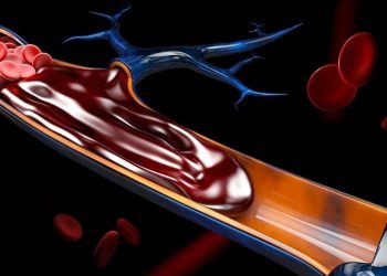 Raising Awareness About Blood Clots: The Role of Non-Profits in Educating the Public and Preventing Tragedies