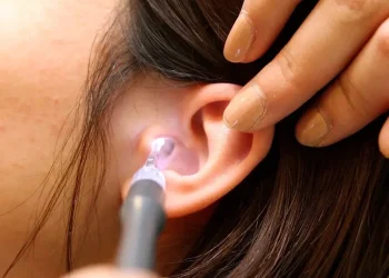 Romford’s Guide to Earwax Cleaning: How Current Reviews Shape Your Decision