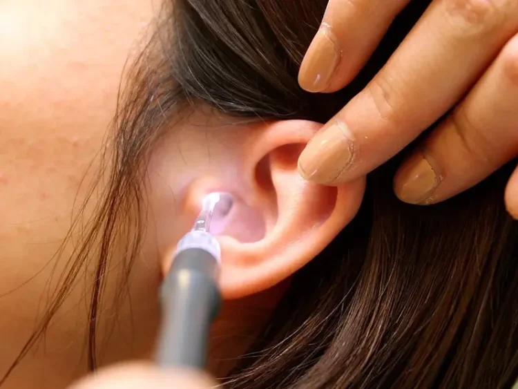 Romford’s Guide to Earwax Cleaning: How Current Reviews Shape Your Decision