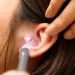 Romford’s Guide to Earwax Cleaning: How Current Reviews Shape Your Decision