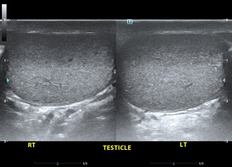 Advanced Diagnostic Technology: Accessing Superior Healthcare Services for Intimate Health Concerns
