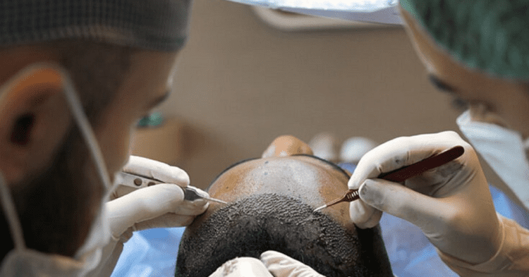 The Practical Power of Recent Hair Transplant Reviews: Expectations, Costs and Outcomes
