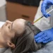 Your Guide to Medical Hair Loss Treatment Options in London